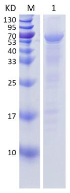15% SDS-PAGE analysis profiles of purified His-RPA1 (CBB stained).